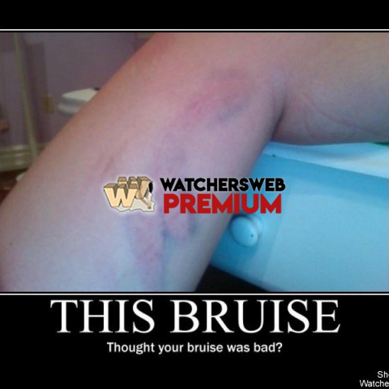 This Bruise - p - Jermaine